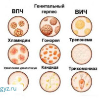 Круглосуточно ПРИЕМ ГИНЕКОЛОГА скидка 50%! Стаж более 10лет! i