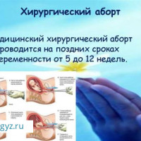 УЗИ❤️АЯЛДАР ДАРЫГЕРИ!❤️МАММОЛОГ ❤️ПОДКОЖНЫЙ ИМПЛАНТ! ❤️АБОРТ❤️