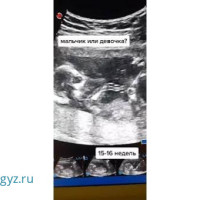 Ведение беременности ❤️Лечение воспалительных заболеваний женских половых органов❤️УЗИ❤️АНАЛИЗЫ ❤️