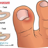 ✅УДАЛЕНИЕ НОГТЯ✅ АЛЛЕРГОЛОГ✅ ГИНЕКОЛОГ ❤️(ЛЕЧЕНИЕ АЛОПЕЦИИ),ТЕРАПЕВТ✅