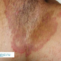 ✅9:00/22:00✅УРОЛОГ, Дерматолог, ФТИЗИАТР, ТЕРАПЕВТ, Гастроэнтеролог, Кардиолог Невролог