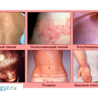 КРУГЛОСУТОЧНО 24/7  ✅Дерматолог Терапевт Гинеколог Уролог СТОМАТОЛОГ (все виды услуг)