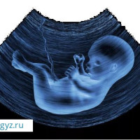 24/7 круглосуточно Гинекология!❤️ ТУКУМСУЗДУК❤️!АБОРТ❤️!СПИРАЛЬ❤️! ПОДКОЖНЫЙ ИМПЛАНТ❤️!