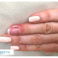 ✅КРУГЛОСУТОЧНО 24/7 ✅ПОДОЛОГ♂️♀️АЛЛЕРГИОЛОГ✅ТЕРАПЕВТ✅ ГАСТРОЭНТЕРОЛОГ ✅ЭНДОКРИНОЛОГ✅ОНКОЛОГ✅