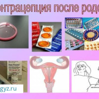 Круглосуточная клиника 24/7✅ Подкожный имплант ❤️Спираль ❤ АБОРТ❤️ ❤️Лечение кисты❤❤️