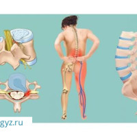 ГИНЕКОЛОГ С БОЛЬШИМ СТАЖЕМ ✅ПОДКОЖНЫЙ ИМПЛАНТ ✅КОЛЬПОСКОПИЯ✅АБОРТ✅СПИРАЛЬ ✅
